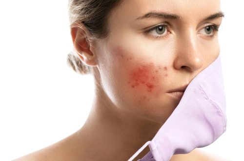 Maskne - acne breakouts from wearing a face mask