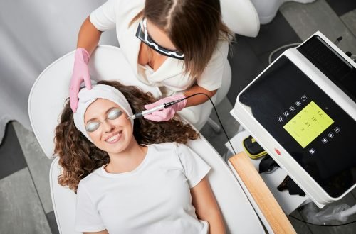 Treatment of telangiectasias with latest laser energy in beauty salon.
